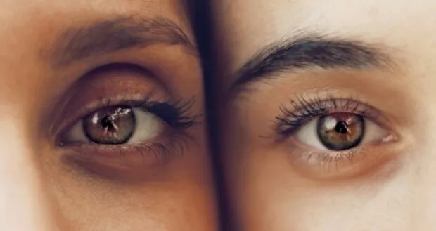 Oculax